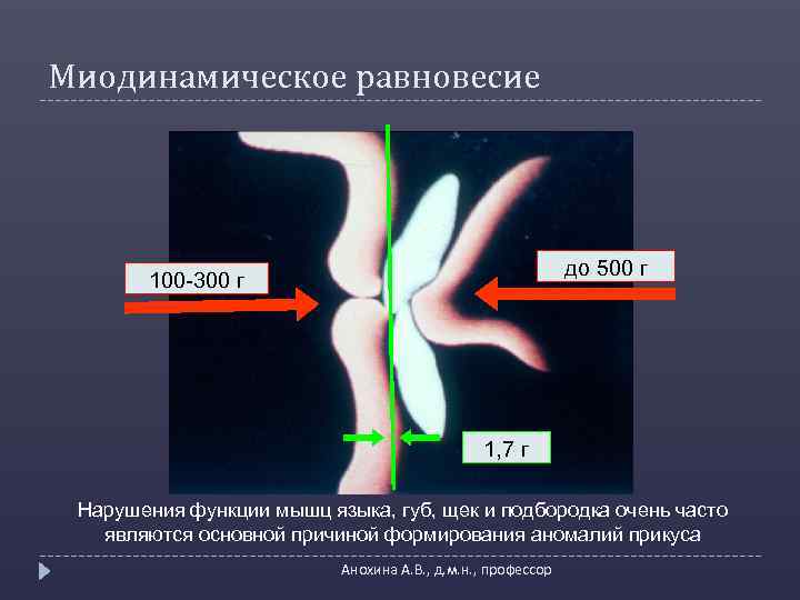 Миодинамическое равновесие до 500 г 100 -300 г 1, 7 г Нарушения функции мышц