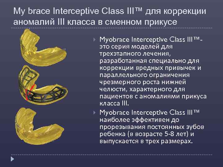 My brace Interceptive Class III™ для коррекции аномалий III класса в сменном прикусе Myobrace