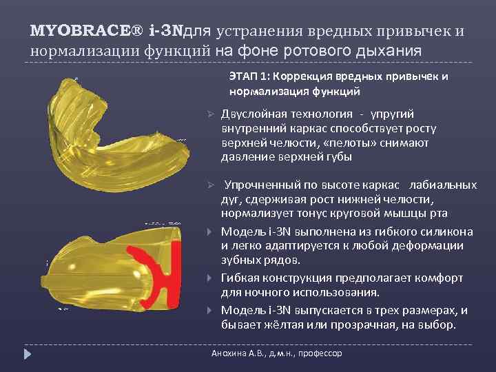 MYOBRACE® i-3 Nдля устранения вредных привычек и нормализации функций на фоне ротового дыхания ЭТАП