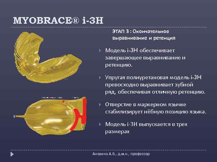 MYOBRACE® i-3 H ЭТАП 3 : Окончательное выравнивание и ретенция Модель i-3 H обеспечивает