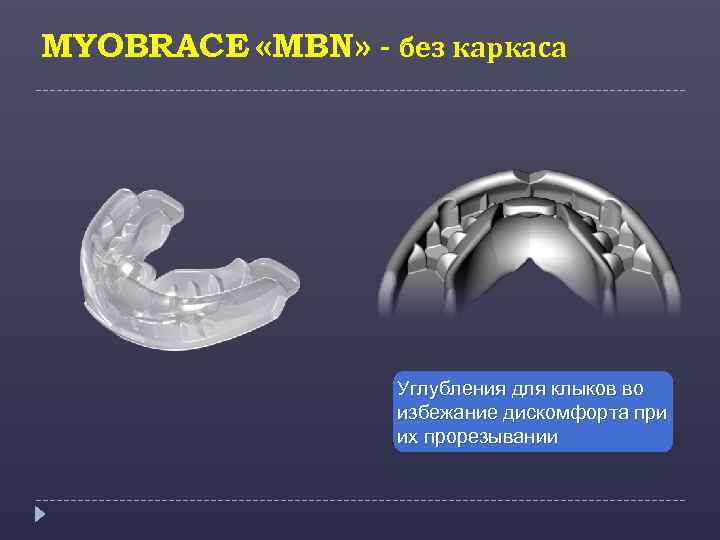 MYOBRACE «MBN» - без каркаса Углубления для клыков во избежание дискомфорта при их прорезывании