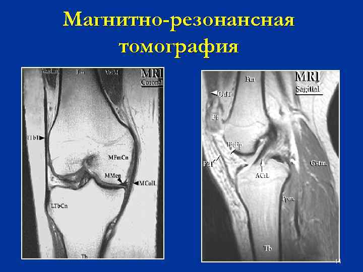 Магнитно-резонансная томография 14 