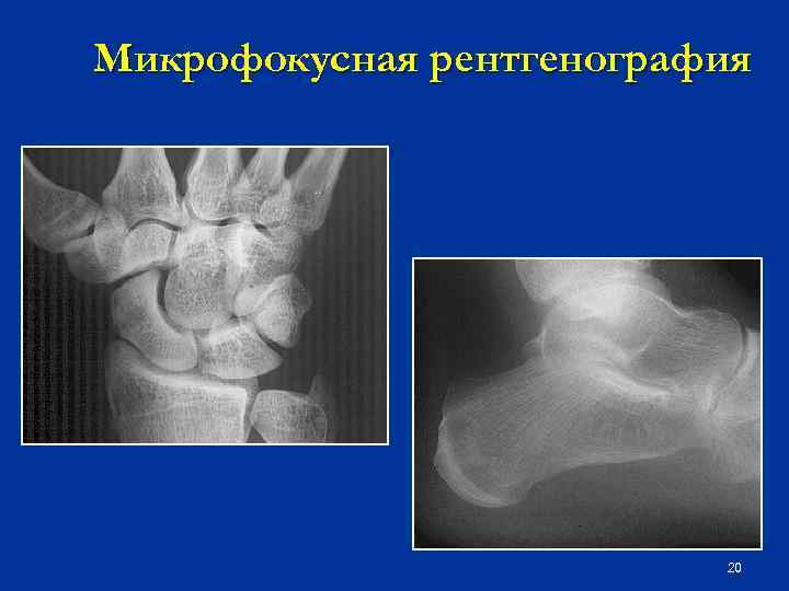 Микрофокусная рентгенография 20 