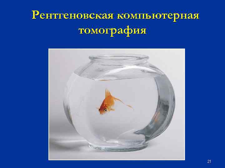 Рентгеновская компьютерная томография 21 