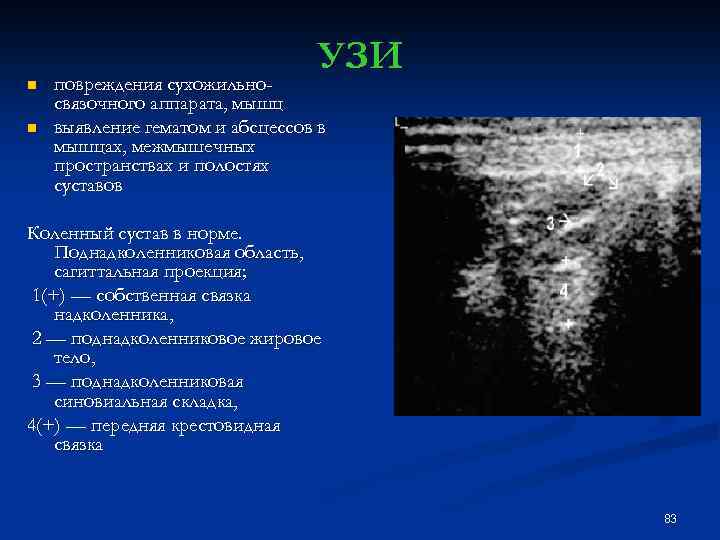 n n УЗИ повреждения сухожильносвязочного аппарата, мышц выявление гематом и абсцессов в мышцах, межмышечных
