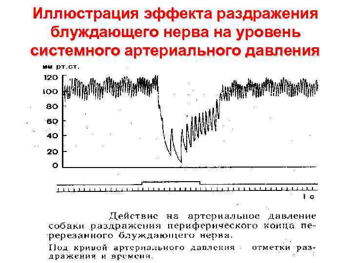 Иллюстрация эффекта раздражения блуждающего нерва на уровень системного артериального давления 