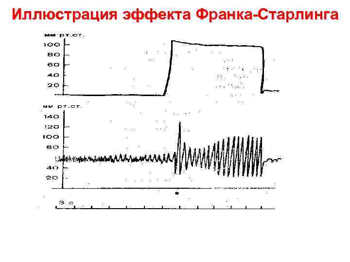 Иллюстрация эффекта Франка-Старлинга 