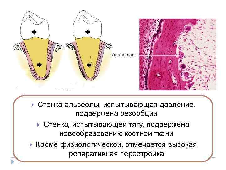 Альвеолярный отросток и стенки зубной альвеолы