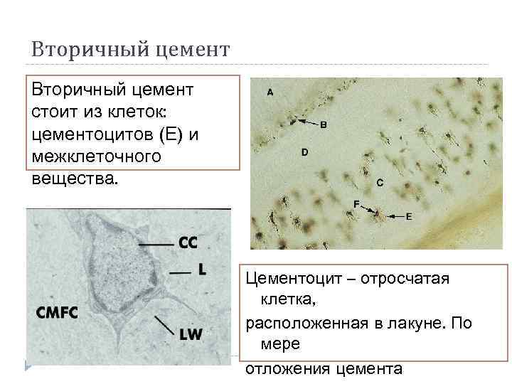 Вторичный цемент стоит из клеток: цементоцитов (Е) и межклеточного вещества. Цементоцит – отросчатая клетка,