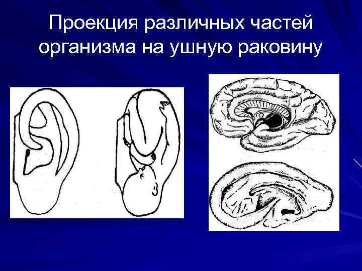 Проекция различных частей организма на ушную раковину 