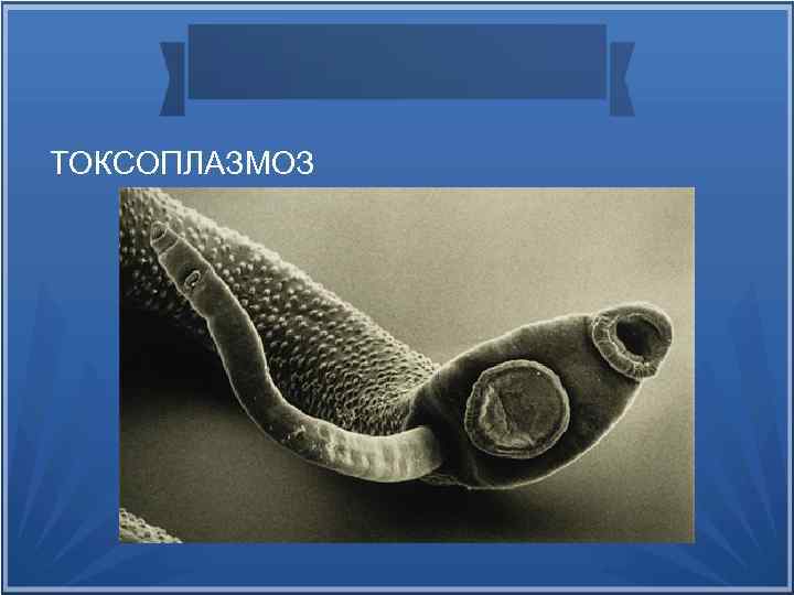 ТОКСОПЛАЗМОЗ 