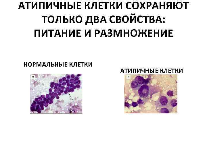 АТИПИЧНЫЕ КЛЕТКИ СОХРАНЯЮТ ТОЛЬКО ДВА СВОЙСТВА: ПИТАНИЕ И РАЗМНОЖЕНИЕ НОРМАЛЬНЫЕ КЛЕТКИ АТИПИЧНЫЕ КЛЕТКИ 