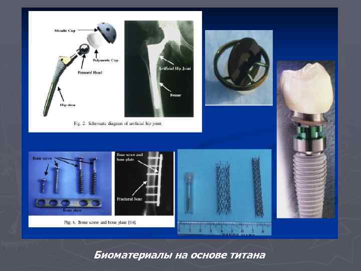 Биоматериалы на основе титана 