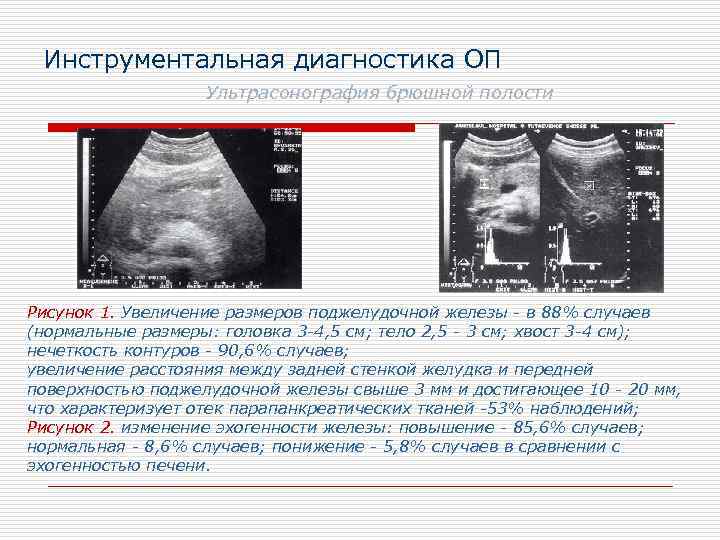 Поджелудочная железа неоднородная эхогенность повышена. Повышение эхогенности поджелудочной железы. Поджелудочная железа повышенной эхогенности. Увеличение размеров поджелудочной железы. Структура однородная повышенной эхогенности поджелудочной железы.