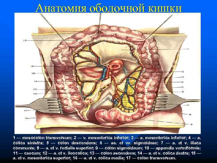 Анатомия ободочной кишки 1 — mesocolon transversum; 2 — v. mesenterica inferior; 3 —