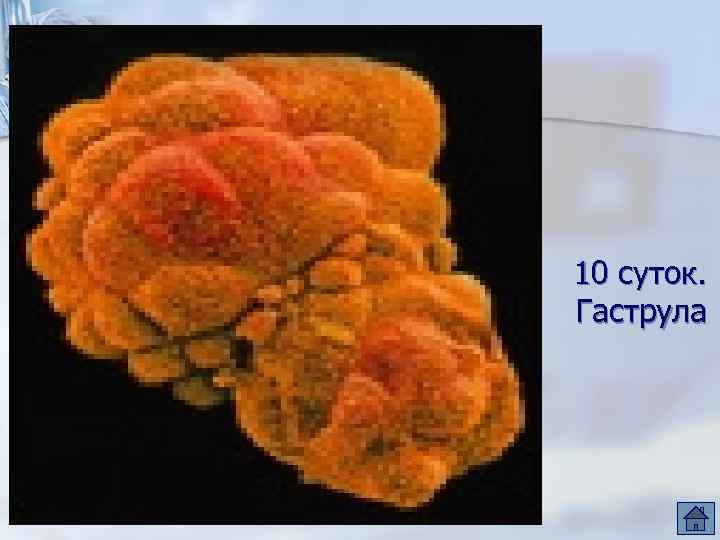 10 суток. Гаструла 