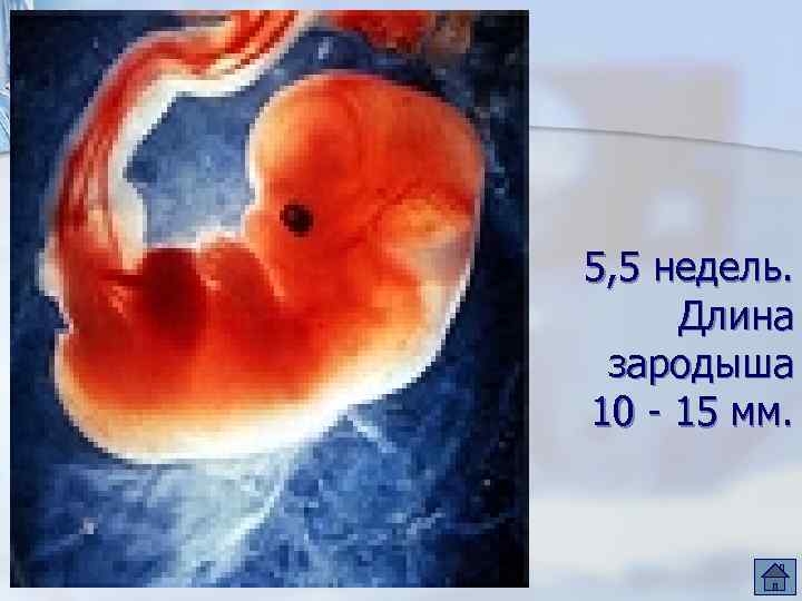 5, 5 недель. Длина зародыша 10 - 15 мм. 
