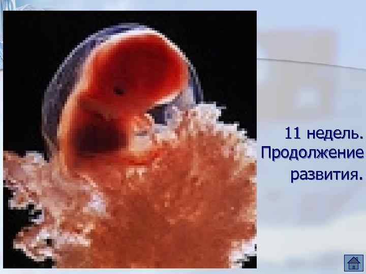 11 недель. Продолжение развития. 