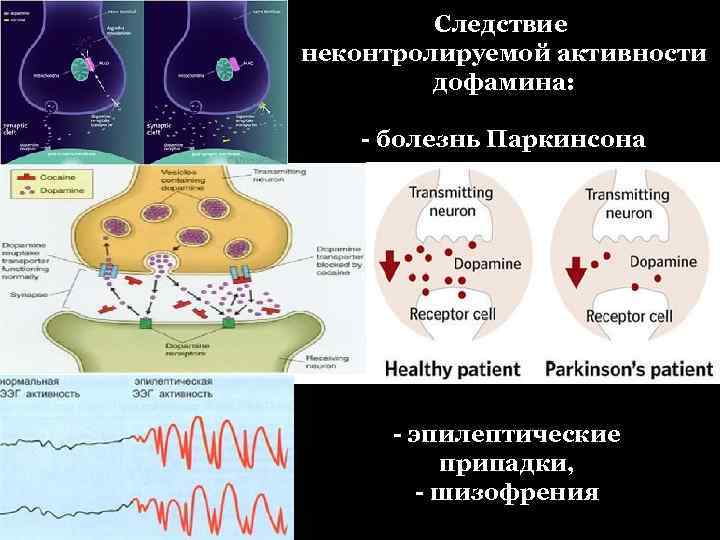 Следствие неконтролируемой активности дофамина: - болезнь Паркинсона - эпилептические припадки, - шизофрения 