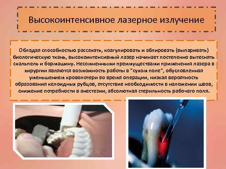 Высокоинтенсивное лазерное излучение Обладая способностью рассекать, коагулировать и аблировать (выпаривать) биологическую ткань, высокоинтенсивный лазер