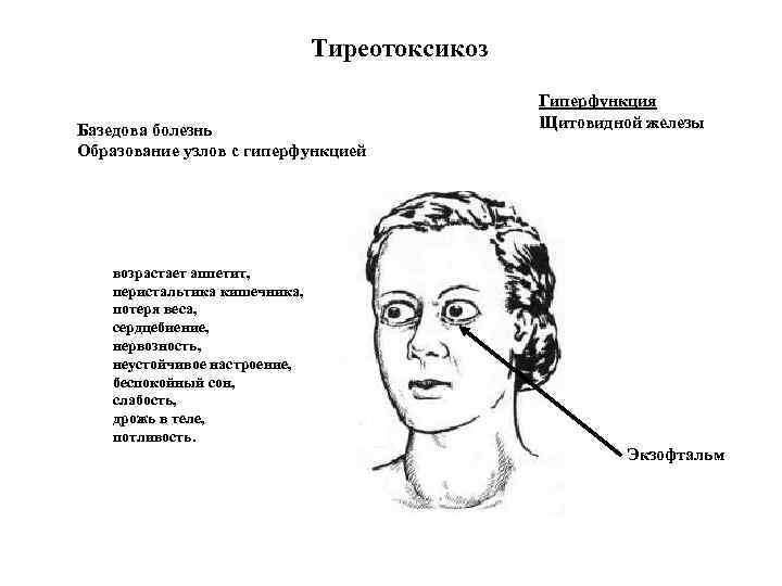 Какое заболевание развивается у человека при нарушении функции изображенной на рисунке железы