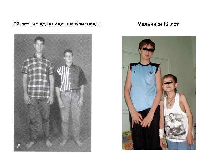 22 -летние однояйцовые близнецы Мальчики 12 лет 