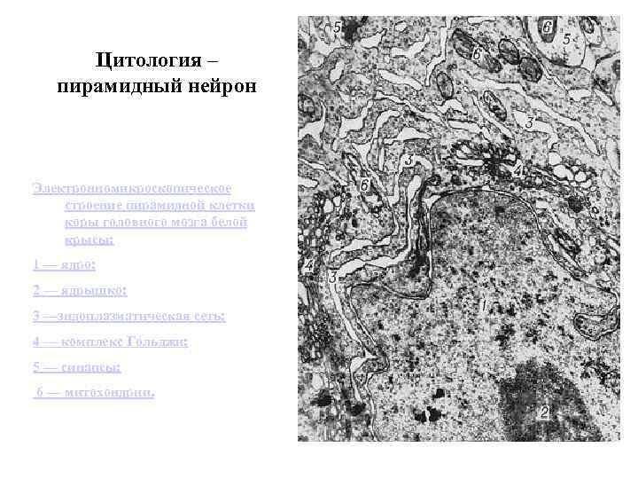 Цитология – пирамидный нейрон Электронномикроскопическое строение пирамидной клетки коры головного мозга белой крысы: 1