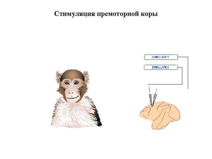 Стимуляция премоторной коры 