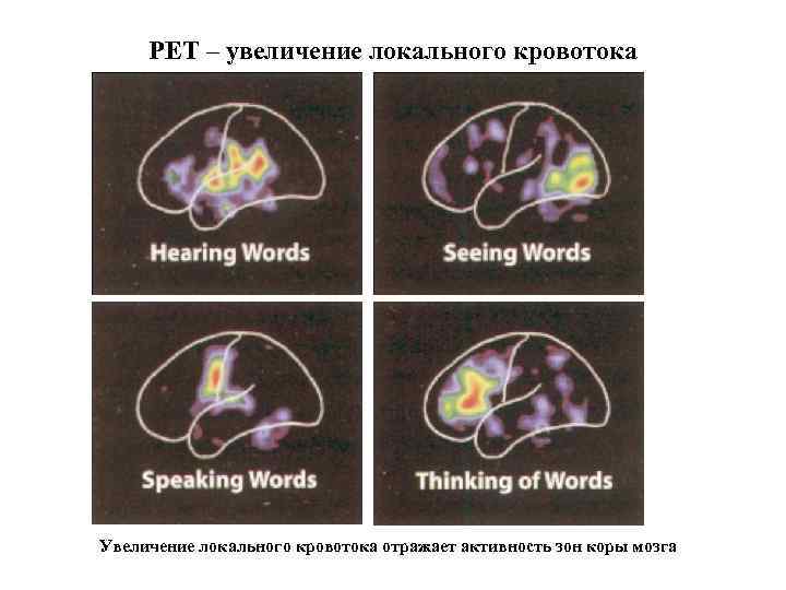 PET – увеличение локального кровотока Увеличение локального кровотока отражает активность зон коры мозга 