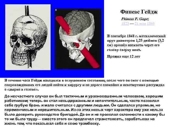 Финеас Гейдж Phineas P. Gage; 1823 — 21 мая 1860 В сентябре 1848 г.