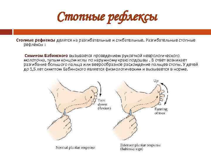 Стопные рефлексы делятся на разгибательные и сгибательные. Разгибательные стопные рефлексы : Симптом Бабинского вызывается