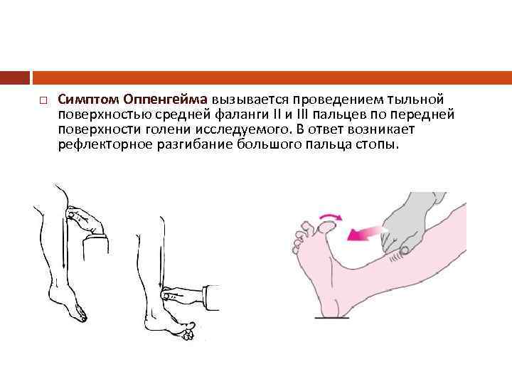  Симптом Оппенгейма вызывается проведением тыльной поверхностью средней фаланги III пальцев по передней поверхности