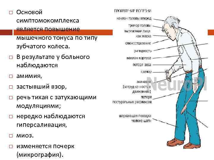  Основой симптомокомплекса является повышение мышечного тонуса по типу зубчатого колеса. В результате у