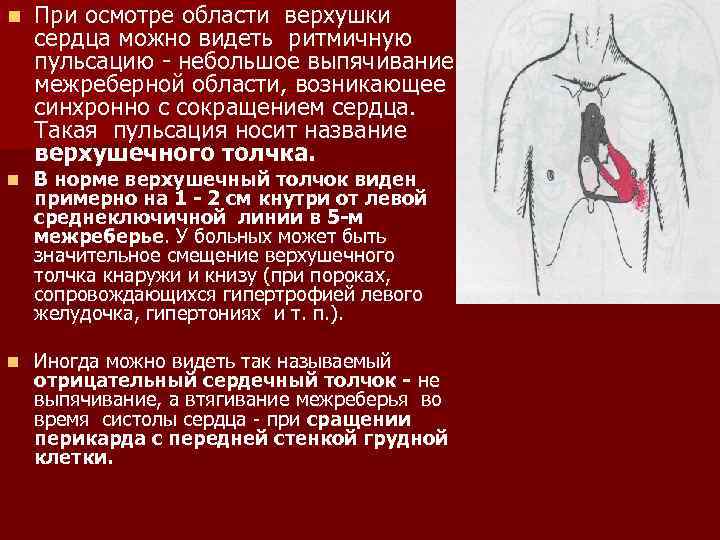 n При осмотре области верхушки сердца можно видеть ритмичную пульсацию - небольшое выпячивание межреберной