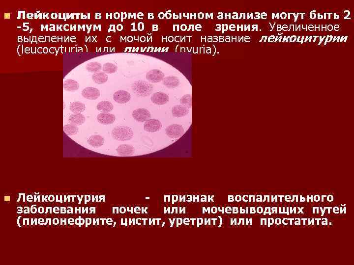 Лейкоциты в моче лейкоцитурия