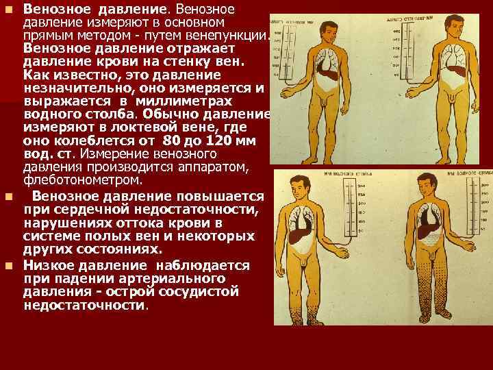 Венозное давление измеряют в основном прямым методом - путем венепункции. Венозное давление отражает давление