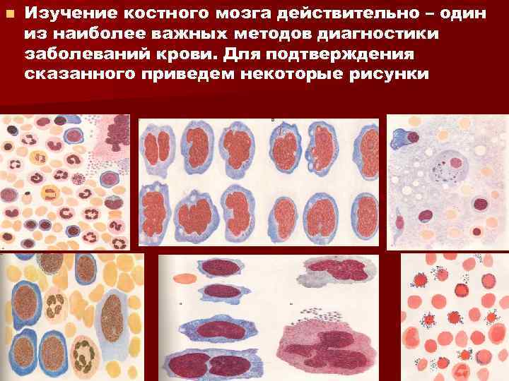 n Изучение костного мозга действительно – один из наиболее важных методов диагностики заболеваний крови.