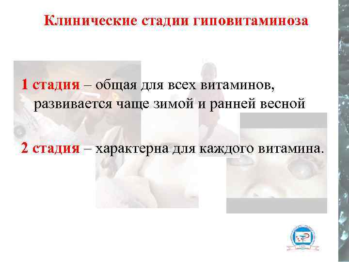 Клинические стадии гиповитаминоза 1 стадия – общая для всех витаминов, развивается чаще зимой и