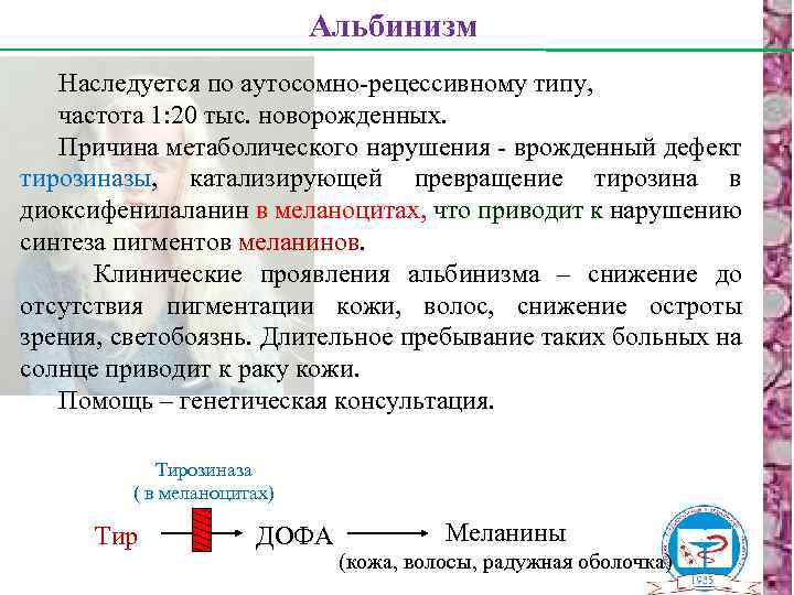 Альбинизм Наследуется по аутосомно-рецессивному типу, частота 1: 20 тыс. новорожденных. Причина метаболического нарушения -