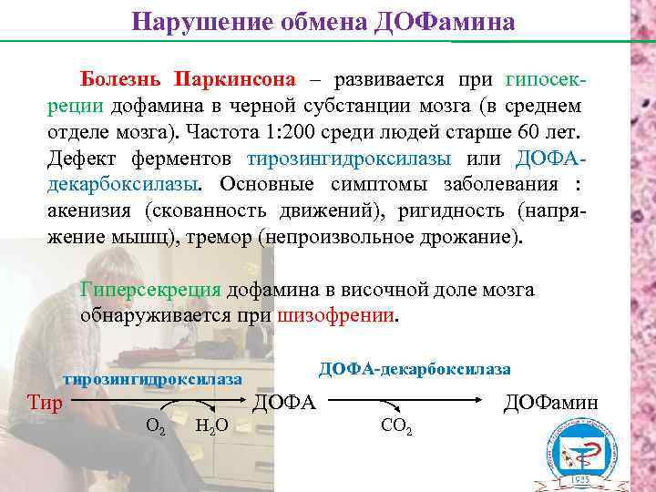 Нарушение обмена ДОФамина Болезнь Паркинсона – развивается при гипосекреции дофамина в черной субстанции мозга