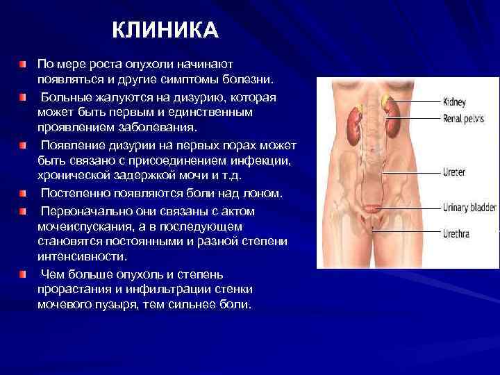 КЛИНИКА По мере роста опухоли начинают появляться и другие симптомы болезни. Больные жалуются на