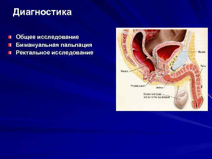 Диагностика Общее исследование Бимануальная пальпация Ректальное исследование 