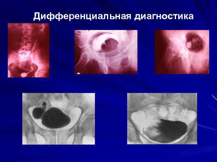 Дифференциальная диагностика 