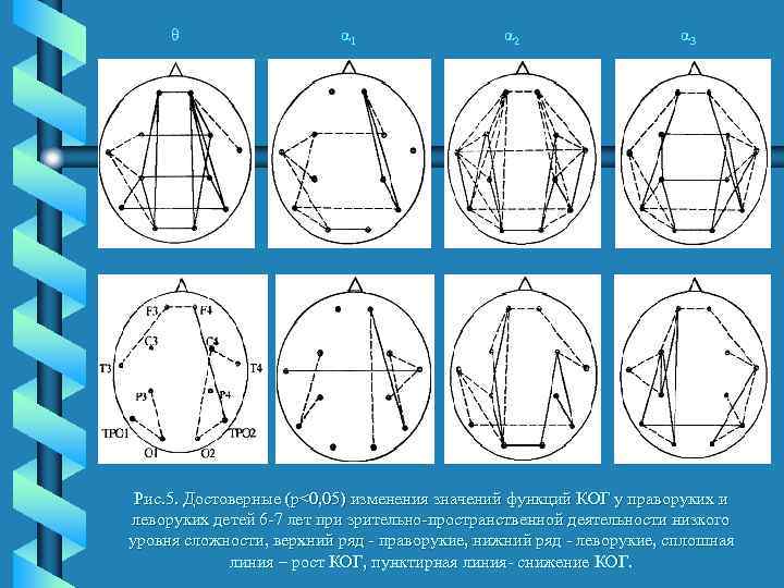 θ α 1 α 2 α 3 Рис. 5. Достоверные (р<0, 05) изменения значений