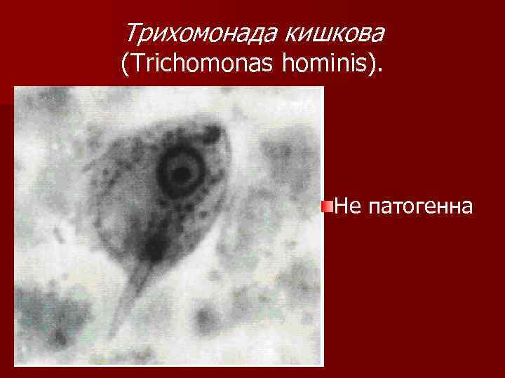 Трихомонада кишкова (Trichomonas hominis). Не патогенна 