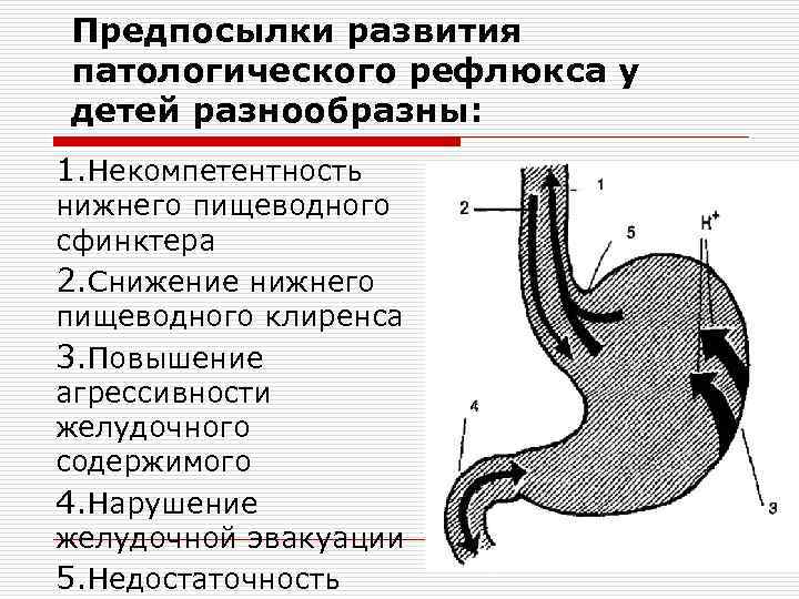 Тонус сфинктера пищевода. Давление Нижнего пищеводного сфинктера. Тонус Нижнего пищеводного сфинктера.