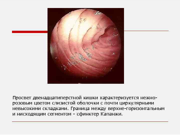 Просвет двенадцатиперстной кишки характеризуется нежнорозовым цветом слизистой оболочки с почти циркулярными невысокими складками. Граница