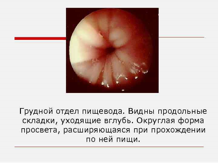 Грудной отдел пищевода. Видны продольные складки, уходящие вглубь. Округлая форма просвета, расширяющаяся при прохождении