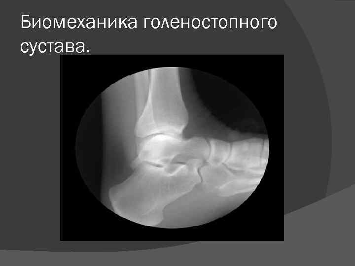 Биомеханика голеностопного сустава. 