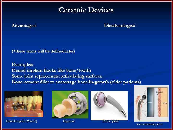 Ceramic Devices Advantages: Disadvantages: (*these terms will be defined later) Examples: Dental implant (looks